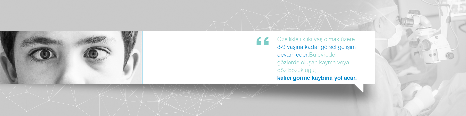 Sasilik tedavisi,Şaşılık Cerrahisi,Şaşı Çocuk, süleyman çataltepe, göz doktoru,göz ameliyatı
 Lazer ameliyatı, 